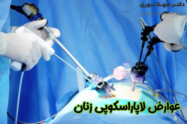 عوارض لاپاراسکوپی زنان
