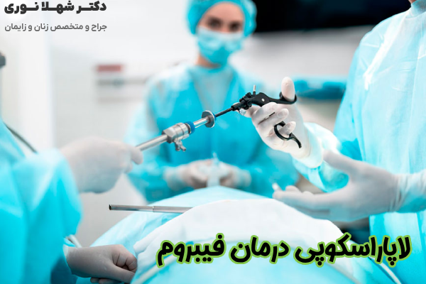 لاپاراسکوپی درمان فیبروم