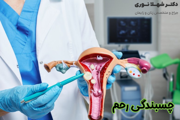چسبندگی رحم