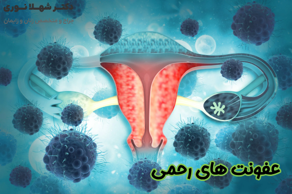 عفونت های رحمی