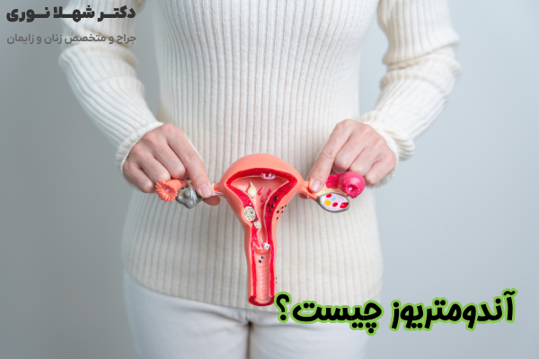 اندومتریوز چیست