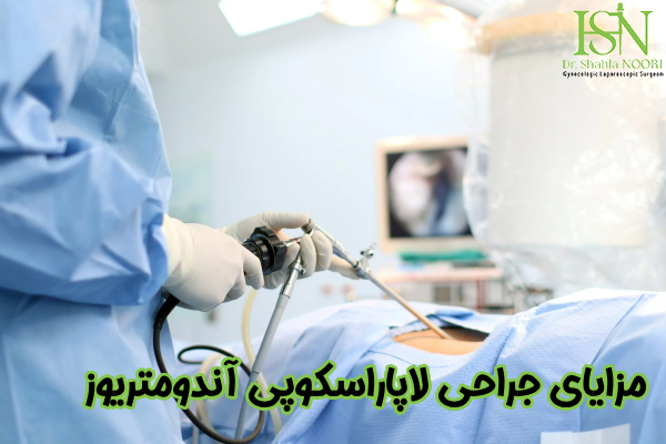 مزایای لاپاراسکوپی آندومتریوز