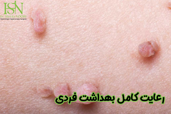 رعایت کامل بهداشت فردی