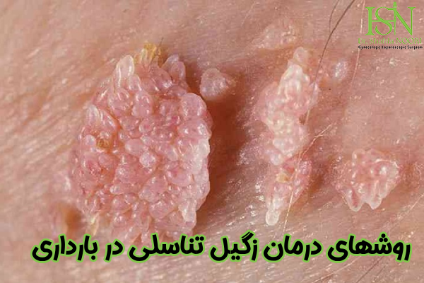 روشهای درمان hpv در بارداری