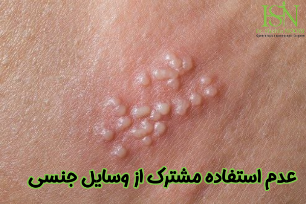 عدم استفاده مشترک از وسایل جنسی