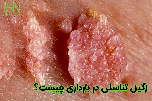 زگیل تناسلی در بارداری چیست