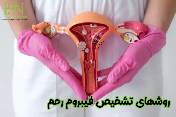 روشهای تشخیص فیبروم رحم