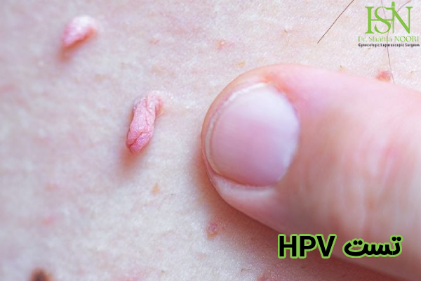 تست hpv