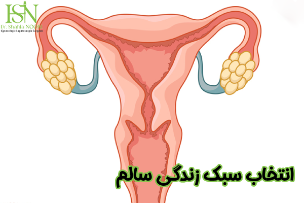انتخاب سبک زندگی سالم