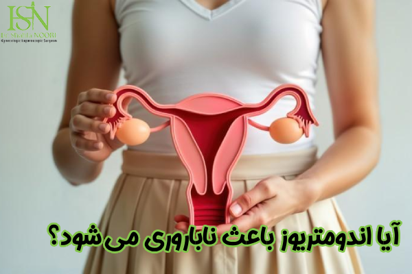 آیا اندومتریوز باعث ناباروری می شود؟