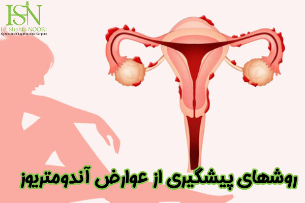 پیشگیری از عوارض آندومتریوز