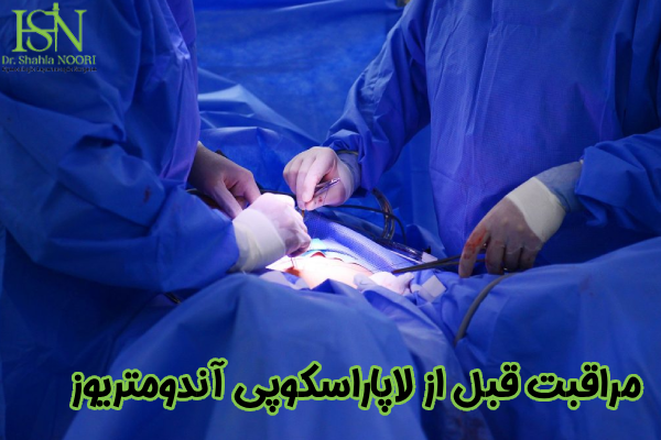 مراقبت قبل از لاپاراسکوپی آندومتریوز