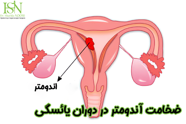 ضخامت آندومتر در یائسگی