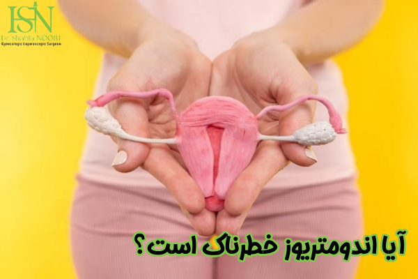 بیماری اندومتریوز خطرناک است