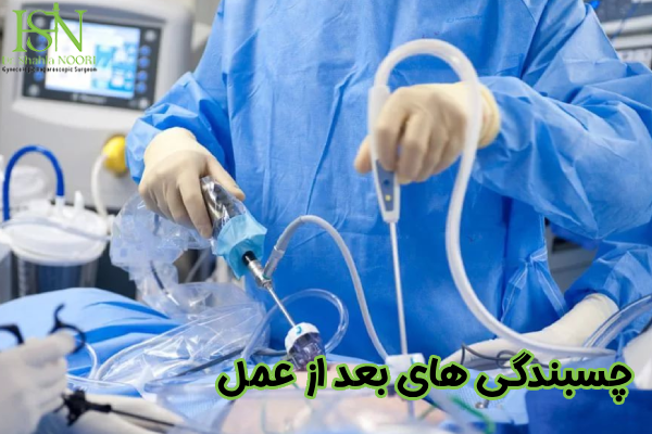 چسبندگی های بعد از عمل