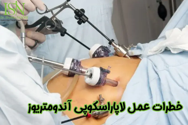 خطرات لاپاراسکوپی آندومتریوز