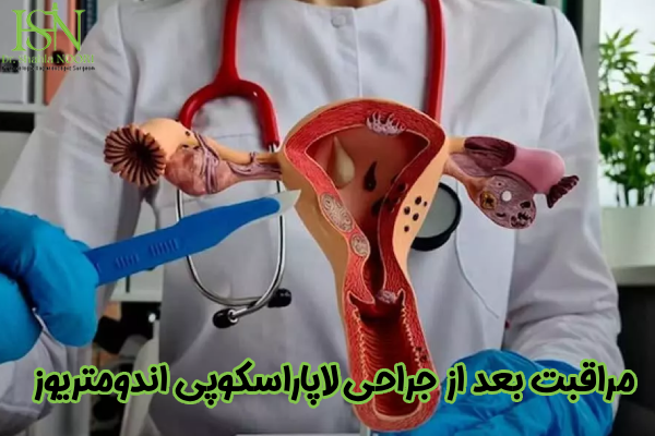 اقدامات بعد از لاپاراسکوپی اندومتریوز