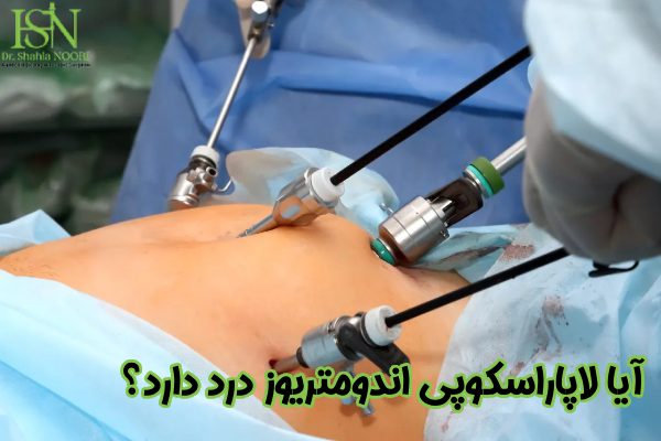 لاپاراسکوپی اندومتریوز درد دارد؟