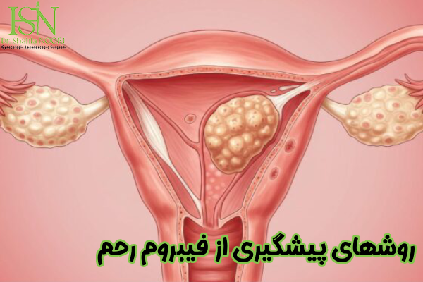 روشهای پیشگیری از فیبروم رحم