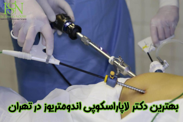 بهترین دکتر لاپاراسکوپی اندومتریوز در تهران