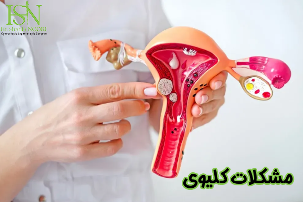 مشکلات کلیوی