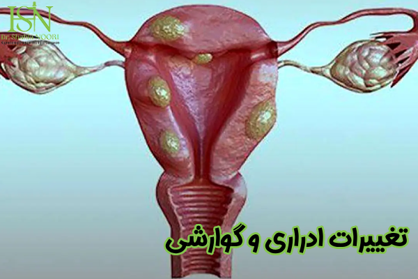 تغییرات ادراری و گوارشی