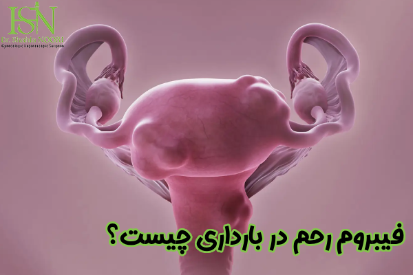 فیبروم رحم در بارداری چیست